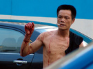 深圳街头—被砍伤的青年男子（有点血腥，胆小者慎入） 